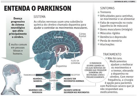 A Doenca De Parkinson Doenca Efeitos Colaterais Da Medicacao Jogo